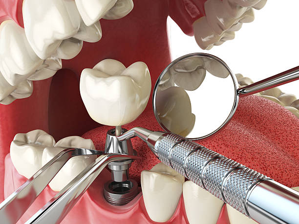 Best Walk-In Emergency Dental Services in Lansing, KS